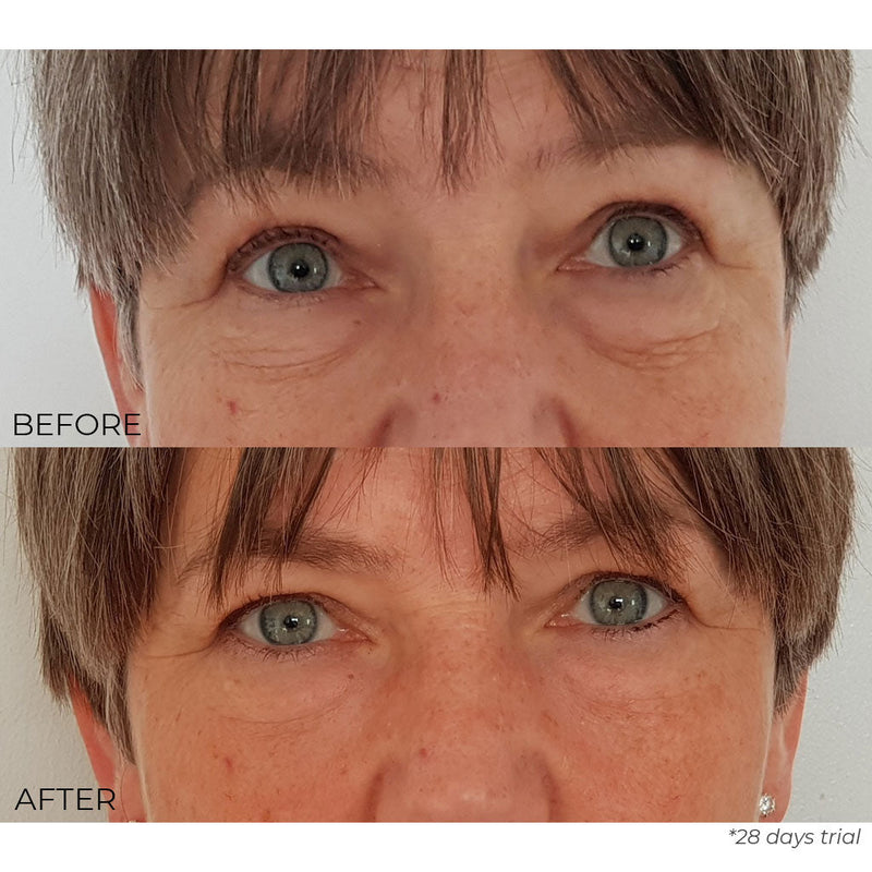 Nourish London Kale Anti-Ageing Eye Cream Results Before After